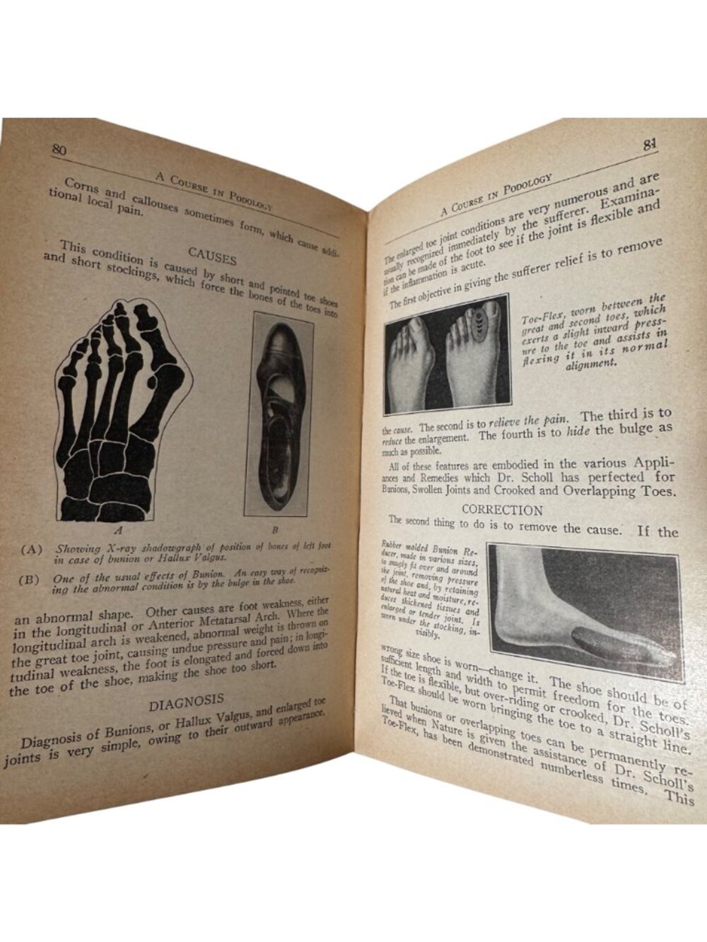 A Course in Podology National School of Podology Illust 1st Edition 1932 HC Book - Picture 10 of 16
